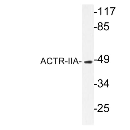 Western Blot - Anti-ACTR-IIA Antibody (R12-2012) - Antibodies.com
