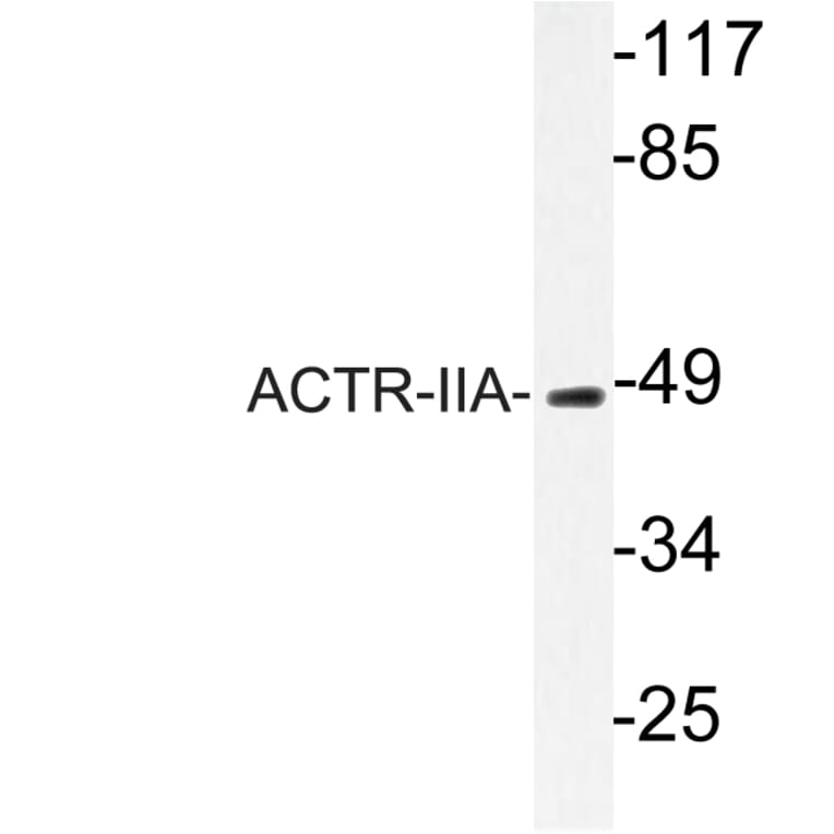 Western Blot - Anti-ACTR-IIA Antibody (R12-2012) - Antibodies.com