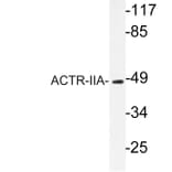 Western Blot - Anti-ACTR-IIA Antibody (R12-2012) - Antibodies.com