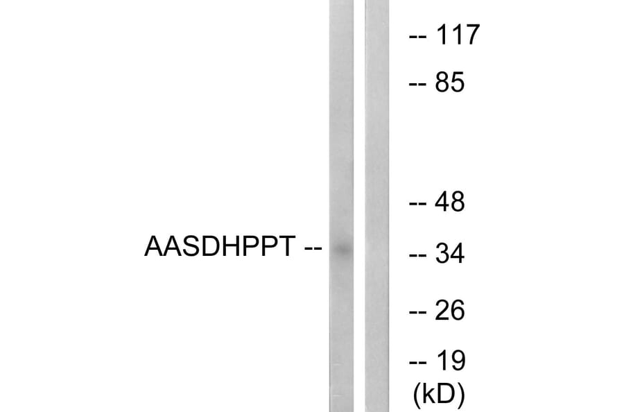 Western Blot - Anti-AASDHPPT Antibody (C16447) - Antibodies.com