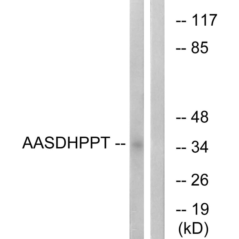 Western Blot - Anti-AASDHPPT Antibody (C16447) - Antibodies.com