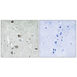 Immunohistochemistry - Anti-AASDHPPT Antibody (C16447) - Antibodies.com
