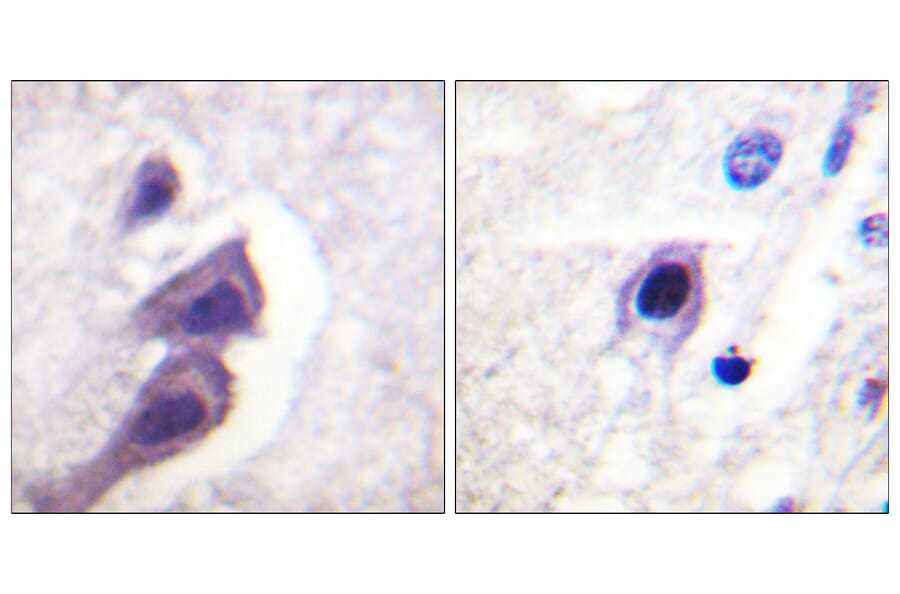 Immunohistochemistry - Anti-Tuberin Antibody (B0591) - Antibodies.com
