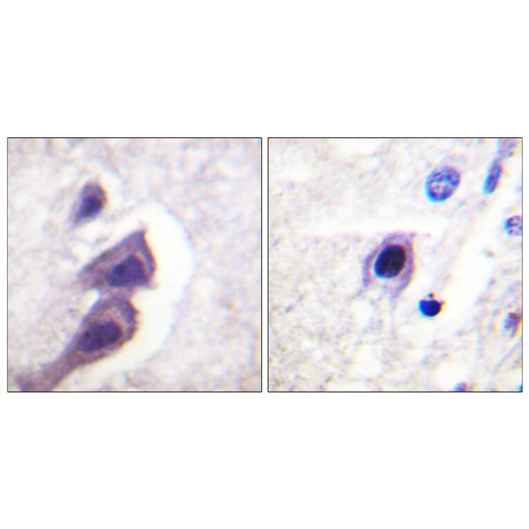 Immunohistochemistry - Anti-Tuberin Antibody (B0591) - Antibodies.com