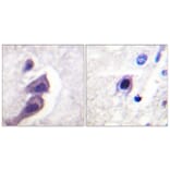 Immunohistochemistry - Anti-Tuberin Antibody (B0591) - Antibodies.com