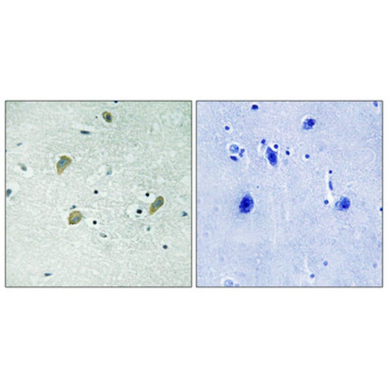 Immunohistochemistry - Anti-CSNK1G1 Antibody (B8089) - Antibodies.com