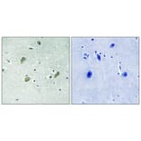 Immunohistochemistry - Anti-CSNK1G1 Antibody (B8089) - Antibodies.com