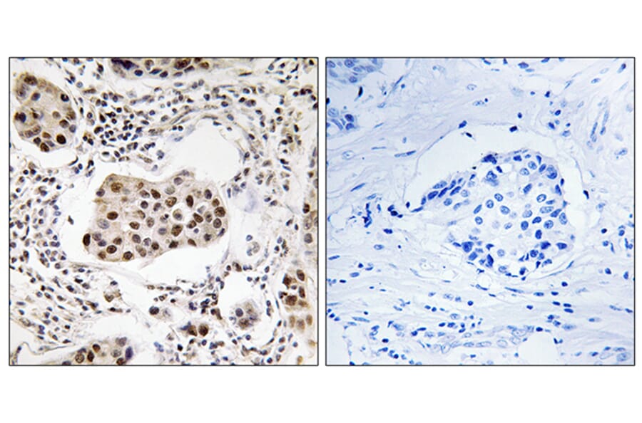 Immunohistochemistry - Anti-PPP1R11 Antibody (C18004) - Antibodies.com