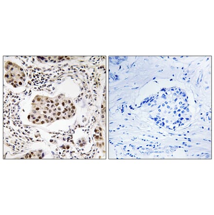Immunohistochemistry - Anti-PPP1R11 Antibody (C18004) - Antibodies.com