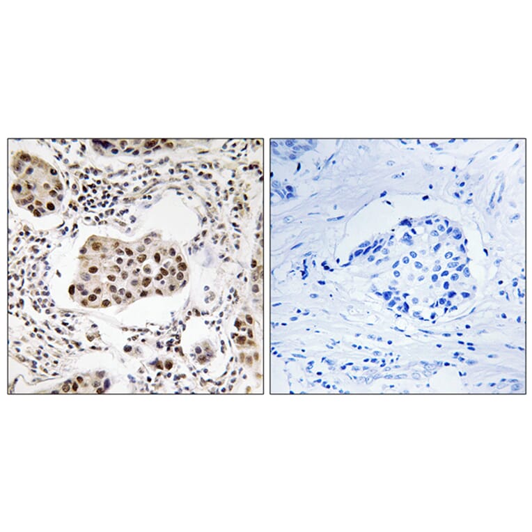 Immunohistochemistry - Anti-PPP1R11 Antibody (C18004) - Antibodies.com