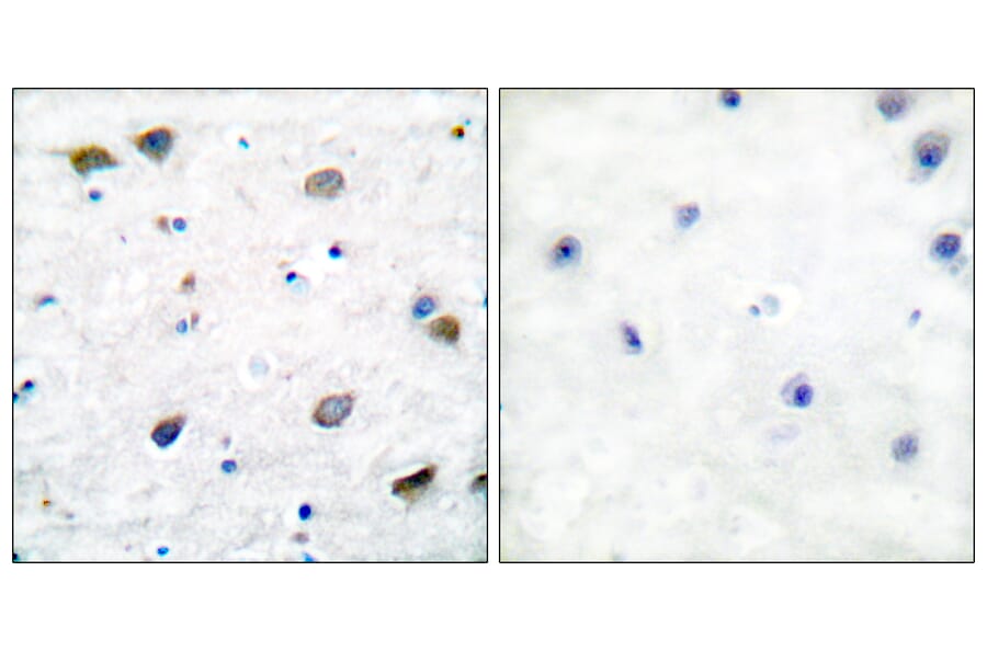 Immunohistochemistry - Anti-GABA-RB Antibody (B0011) - Antibodies.com