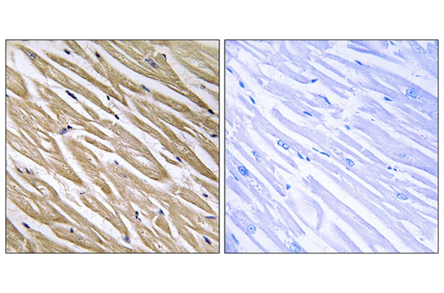 Immunohistochemistry - Anti-C5orf13 Antibody (C17005) - Antibodies.com