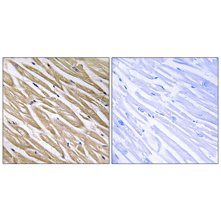 Immunohistochemistry - Anti-C5orf13 Antibody (C17005) - Antibodies.com
