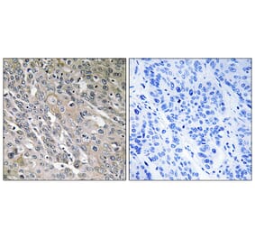Immunohistochemistry - Anti-ARHGEF9 Antibody (C18398) - Antibodies.com