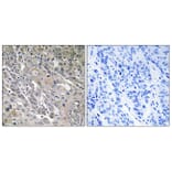 Immunohistochemistry - Anti-ARHGEF9 Antibody (C18398) - Antibodies.com