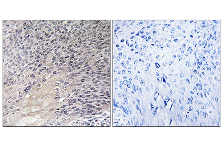 Immunohistochemistry - Anti-ARHGDIA Antibody (B1189) - Antibodies.com