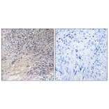 Immunohistochemistry - Anti-ARHGDIA Antibody (B1189) - Antibodies.com