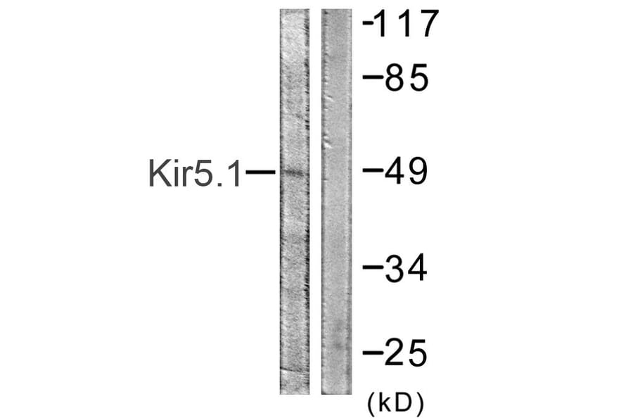 Western Blot - Anti-Kir5.1 Antibody (B1083) - Antibodies.com
