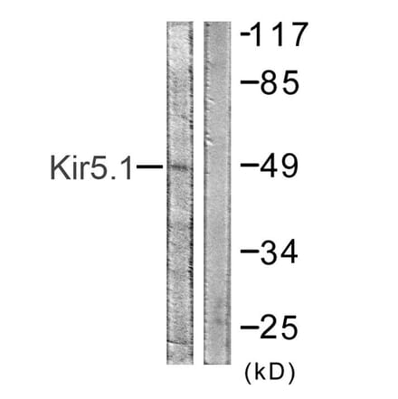 Western Blot - Anti-Kir5.1 Antibody (B1083) - Antibodies.com