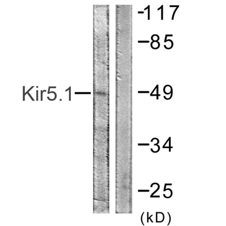 Western Blot - Anti-Kir5.1 Antibody (B1083) - Antibodies.com