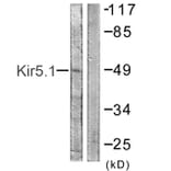 Western Blot - Anti-Kir5.1 Antibody (B1083) - Antibodies.com
