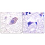 Immunohistochemistry - Anti-Kir5.1 Antibody (B1083) - Antibodies.com