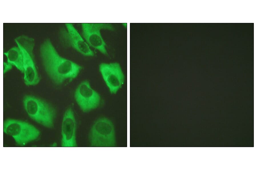 Immunofluorescence - Anti-Kir5.1 Antibody (B1083) - Antibodies.com