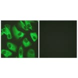 Immunofluorescence - Anti-Kir5.1 Antibody (B1083) - Antibodies.com