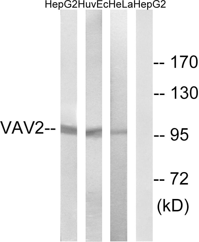 Western blot analysis of lysates from HepG HUVEC, and HeLa cells using Anti-VAV2 Antibody. The right hand lane represents a negative control, where the antibody is blocked by the immunising peptide.