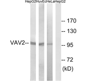 Western Blot - Anti-VAV2 Antibody (B1241) - Antibodies.com
