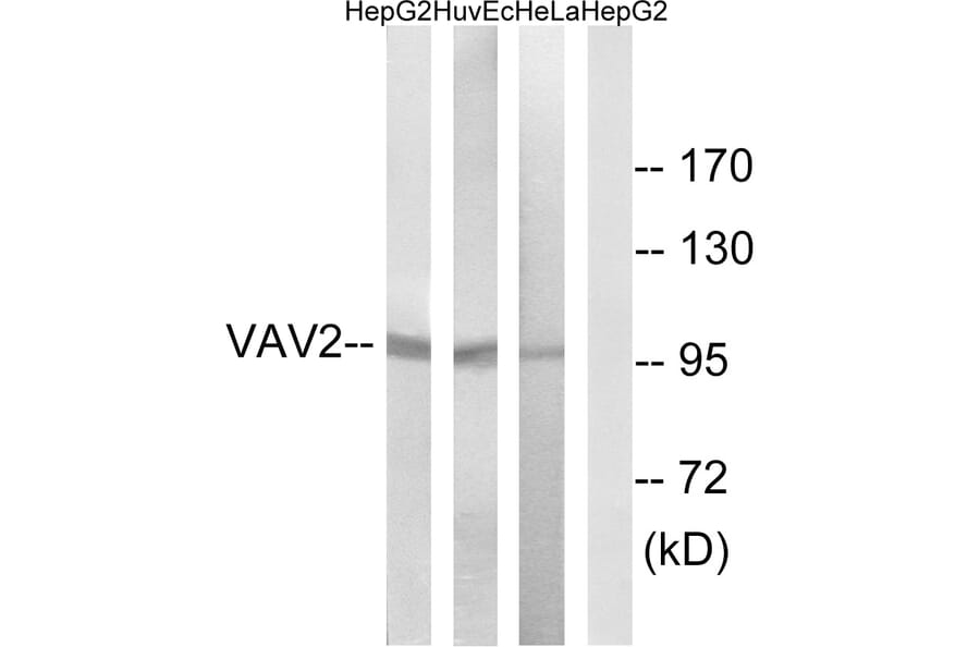 Western Blot - Anti-VAV2 Antibody (B1241) - Antibodies.com