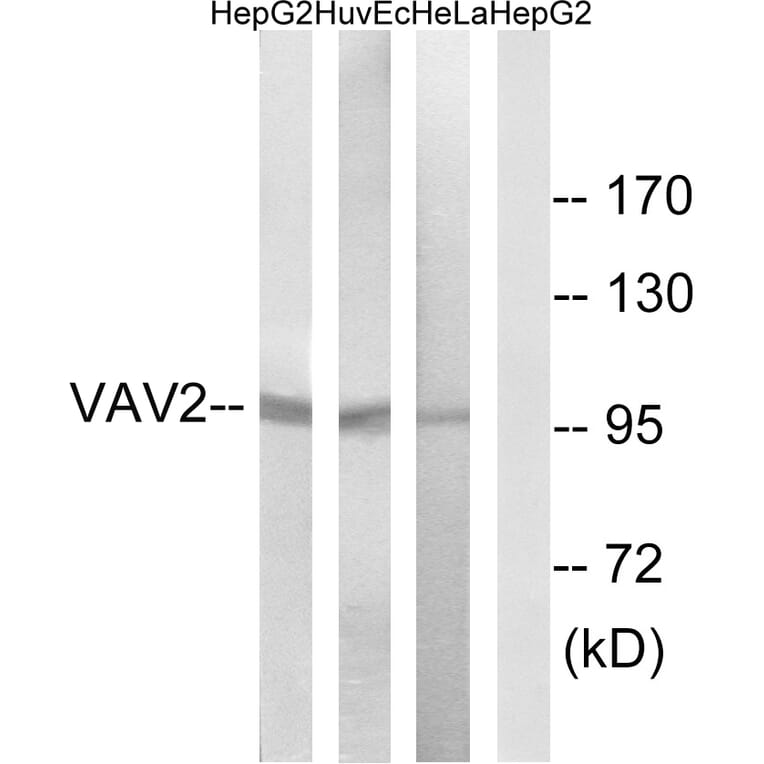 Western Blot - Anti-VAV2 Antibody (B1241) - Antibodies.com