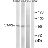 Western Blot - Anti-VAV2 Antibody (B1241) - Antibodies.com