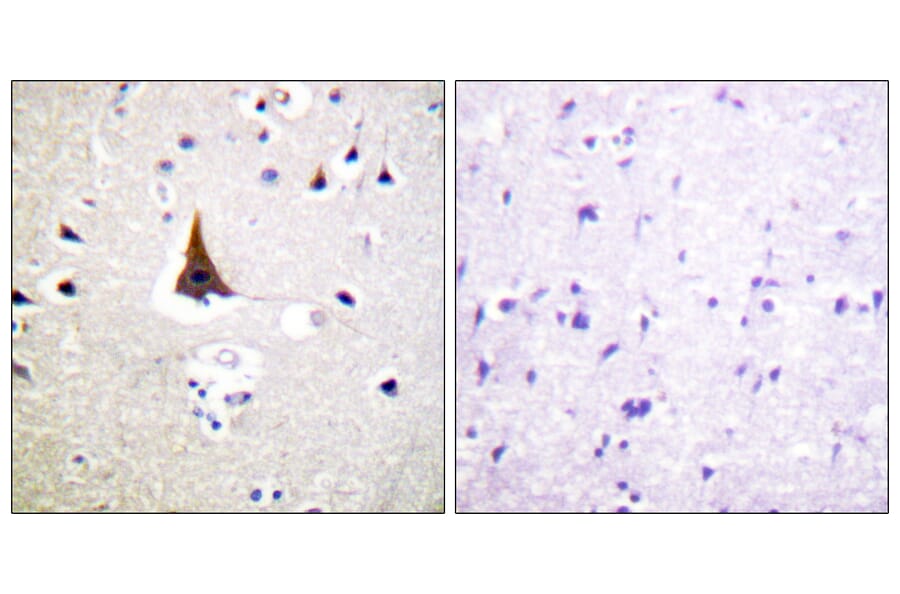 Immunohistochemistry - Anti-VAV2 Antibody (B1241) - Antibodies.com