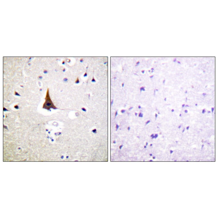 Immunohistochemistry - Anti-VAV2 Antibody (B1241) - Antibodies.com