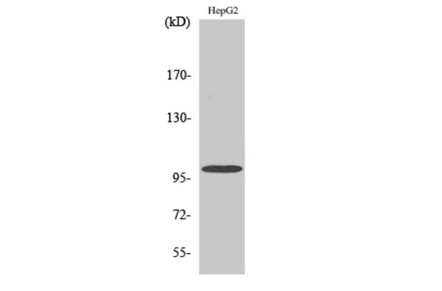Western Blot - Anti-VAV2 Antibody (B1241) - Antibodies.com