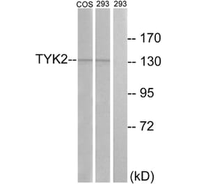 Western Blot - Anti-TYK2 Antibody (B7248) - Antibodies.com