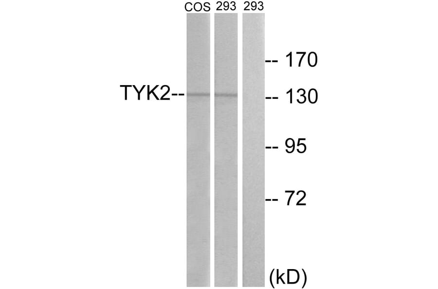 Western Blot - Anti-TYK2 Antibody (B7248) - Antibodies.com