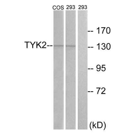 Western Blot - Anti-TYK2 Antibody (B7248) - Antibodies.com