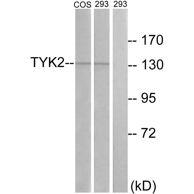 Western Blot - Anti-TYK2 Antibody (B7248) - Antibodies.com