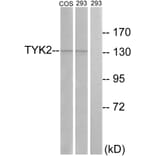 Western Blot - Anti-TYK2 Antibody (B7248) - Antibodies.com
