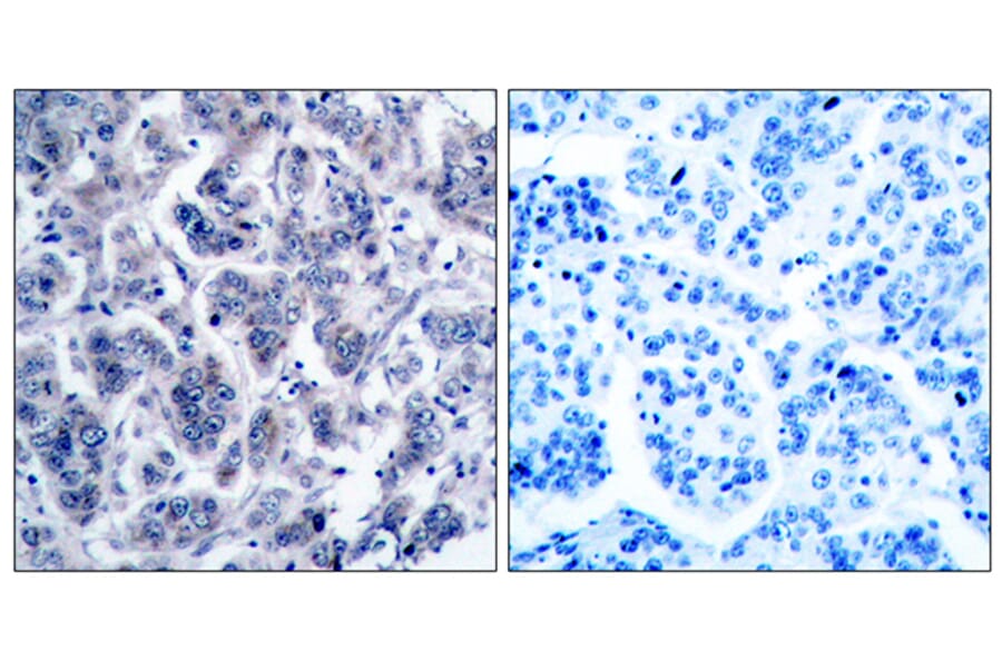 Immunohistochemistry - Anti-TYK2 Antibody (B7248) - Antibodies.com