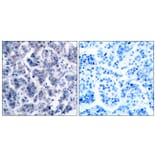 Immunohistochemistry - Anti-TYK2 Antibody (B7248) - Antibodies.com