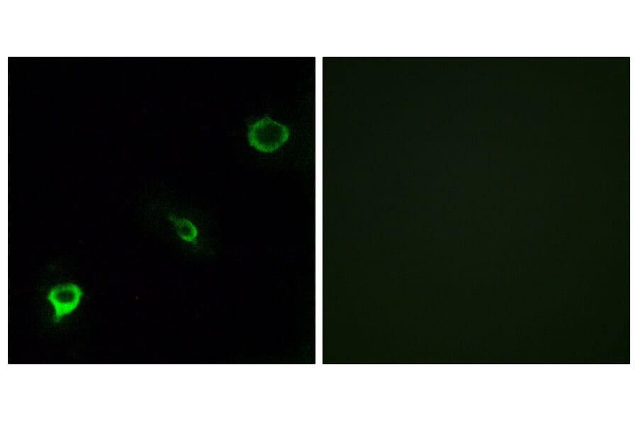 Immunofluorescence - Anti-TYK2 Antibody (B7248) - Antibodies.com