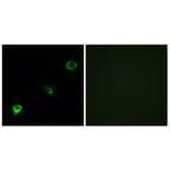 Immunofluorescence - Anti-TYK2 Antibody (B7248) - Antibodies.com