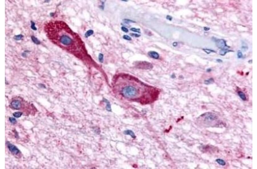 Western Blot - Anti-TRHR Antibody (G954) - Antibodies.com