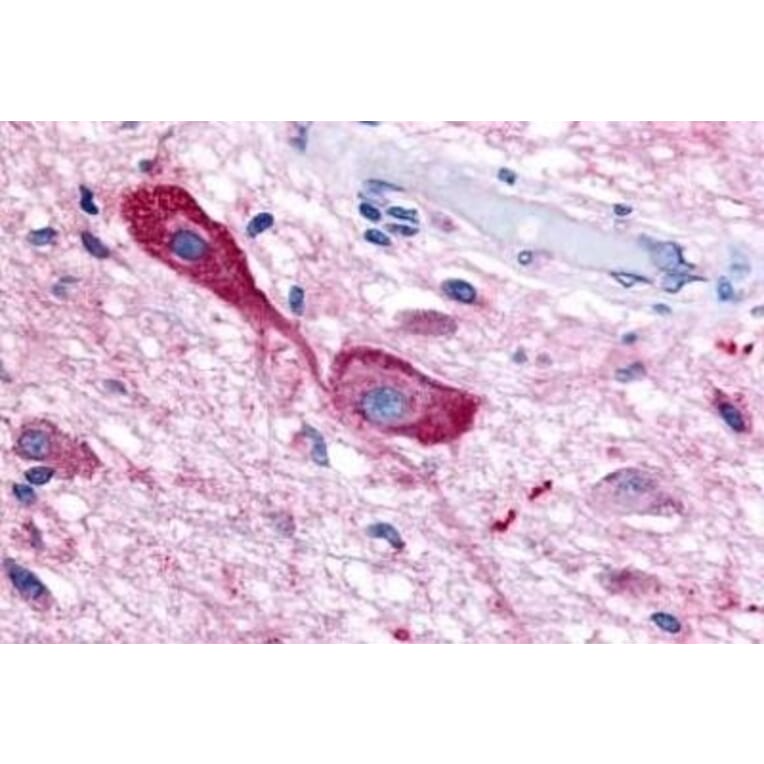 Western Blot - Anti-TRHR Antibody (G954) - Antibodies.com