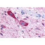 Western Blot - Anti-TRHR Antibody (G954) - Antibodies.com