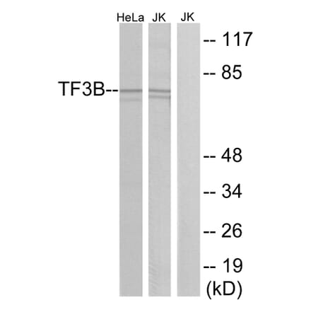 Western Blot - Anti-TF3B Antibody (C11452) - Antibodies.com