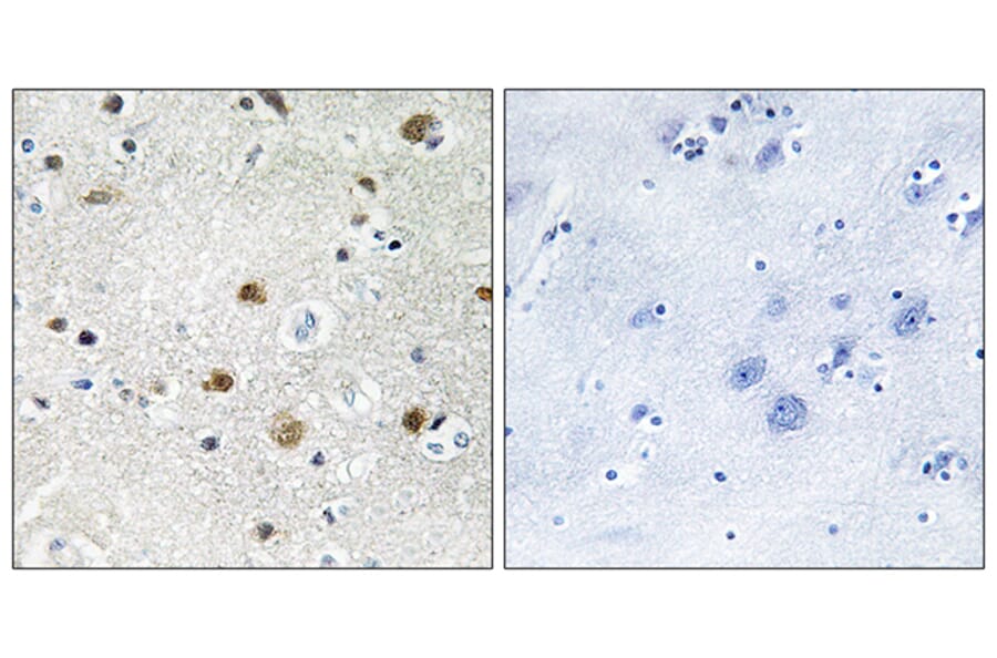Immunohistochemistry - Anti-TF3B Antibody (C11452) - Antibodies.com